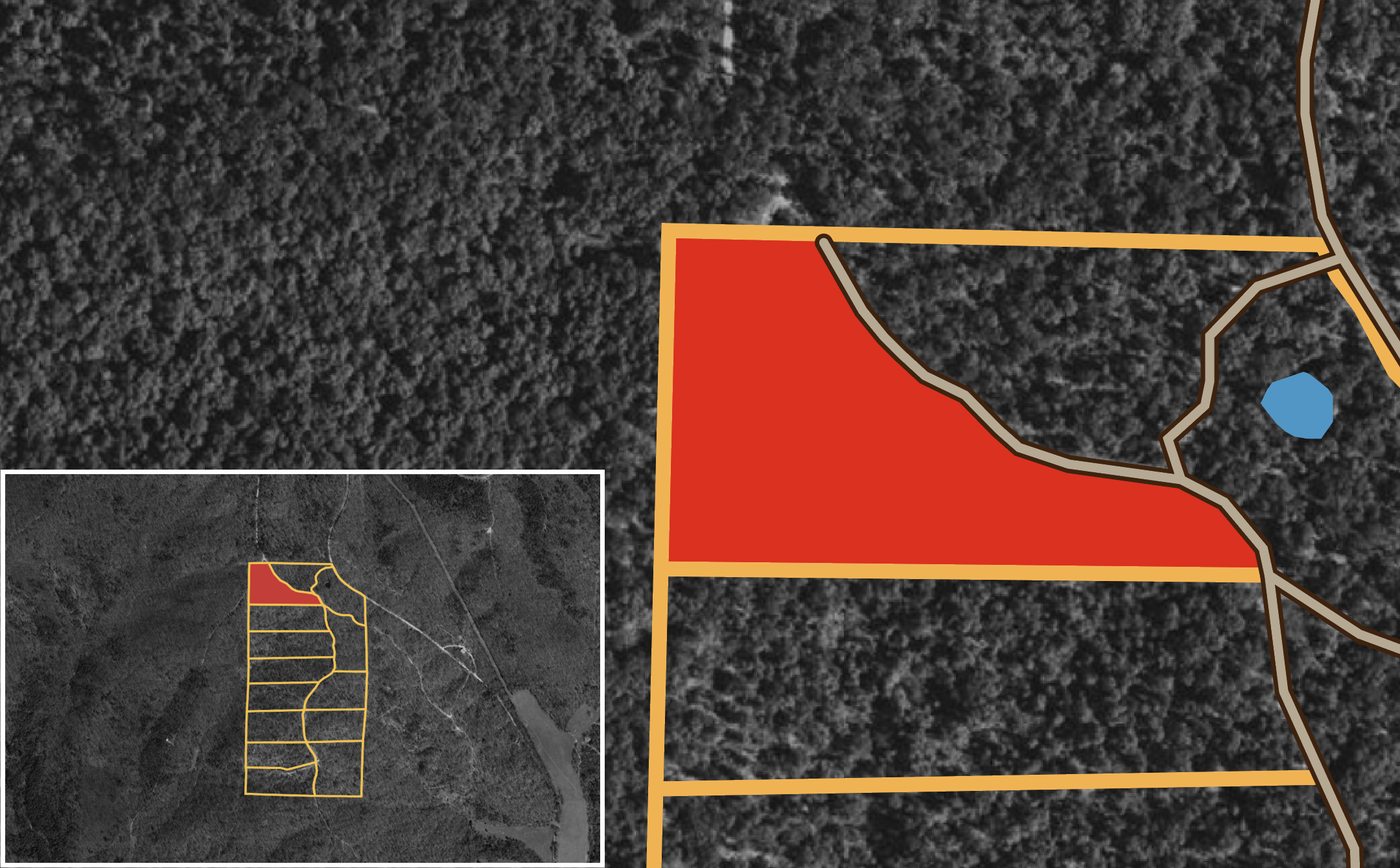 FXHL-T1 tract image
